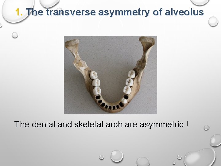 1. The transverse asymmetry of alveolus The dental and skeletal arch are asymmetric ! 1. The transverse asymmetry of alveolus The dental and skeletal arch are asymmetric !