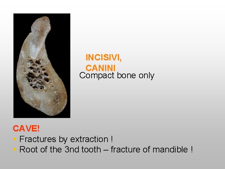 INCISIVI, CANINI Compact bone only CAVE! § Fractures by extraction ! § Root of