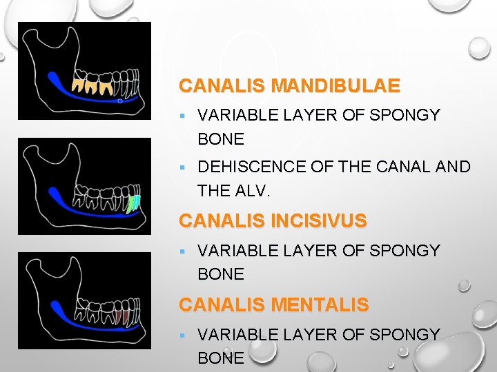 CANALIS MANDIBULAE § VARIABLE LAYER OF SPONGY BONE § DEHISCENCE OF THE CANAL AND