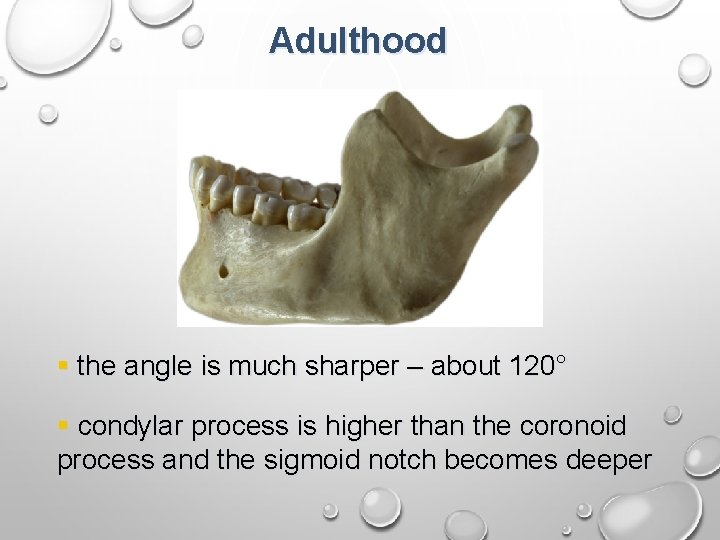 Adulthood § the angle is much sharper – about 120° § condylar process is