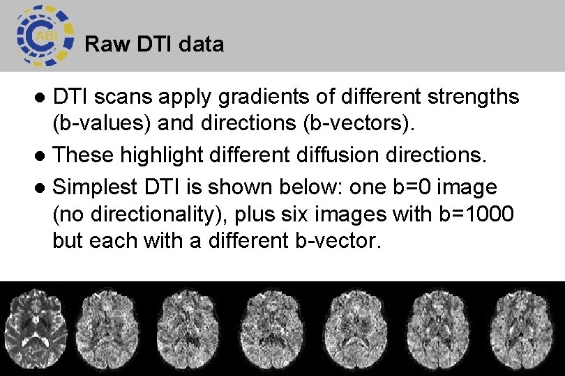 Raw DTI data DTI scans apply gradients of different strengths (b-values) and directions (b-vectors).