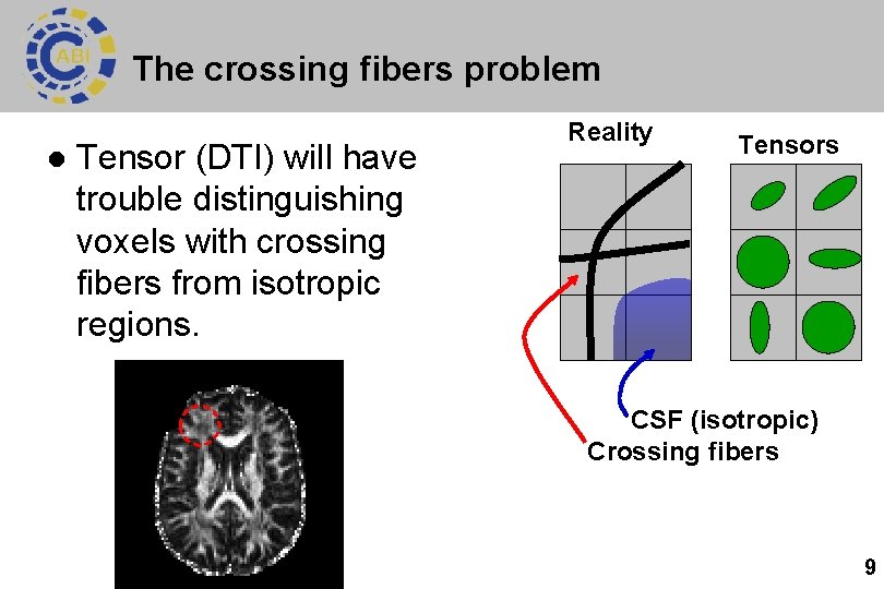 The crossing fibers problem l Tensor (DTI) will have trouble distinguishing voxels with crossing