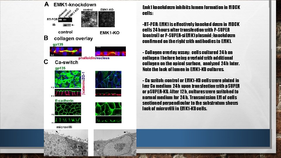 Emk 1 knockdown inhibits lumen formation in MDCK cells: -RT-PCR: EMK 1 is effectively