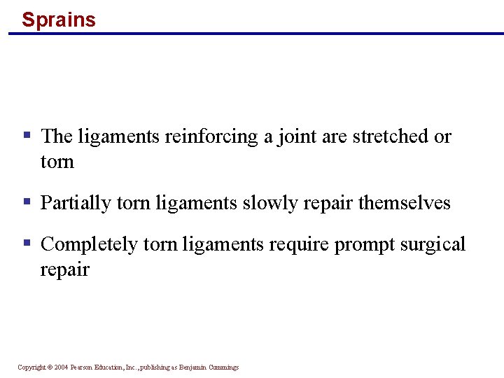 Sprains § The ligaments reinforcing a joint are stretched or torn § Partially torn