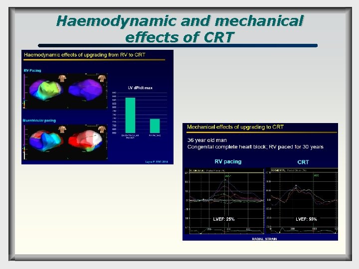 Haemodynamic and mechanical effects of CRT 