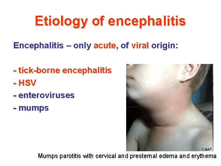 Etiology of encephalitis Encephalitis – only acute, of viral origin: - tick-borne encephalitis - Etiology of encephalitis Encephalitis – only acute, of viral origin: - tick-borne encephalitis -
