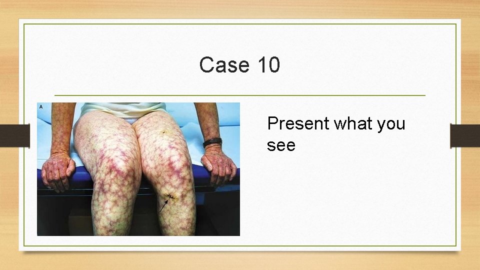 Case 10 Present what you see 