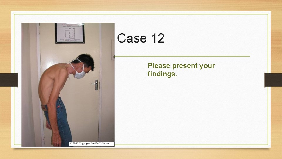 Case 12 Please present your findings. 