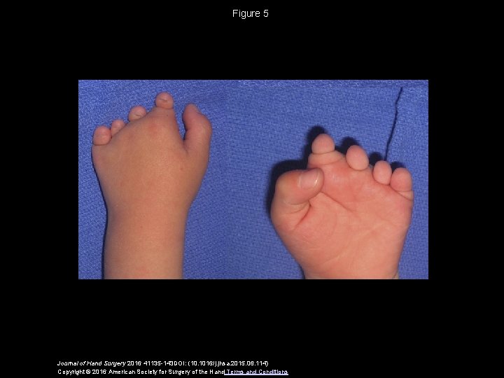 Figure 5 Journal of Hand Surgery 2016 41135 -143 DOI: (10. 1016/j. jhsa. 2015.