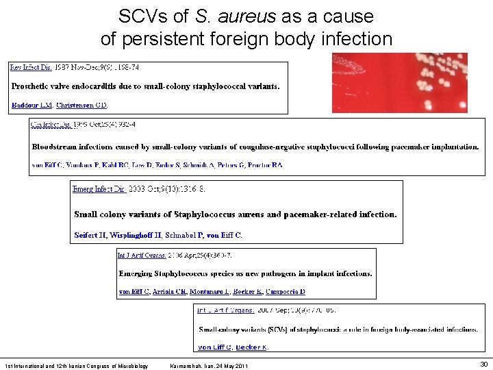 SCVs of S. aureus as a cause of persistent foreign body infection 1 st