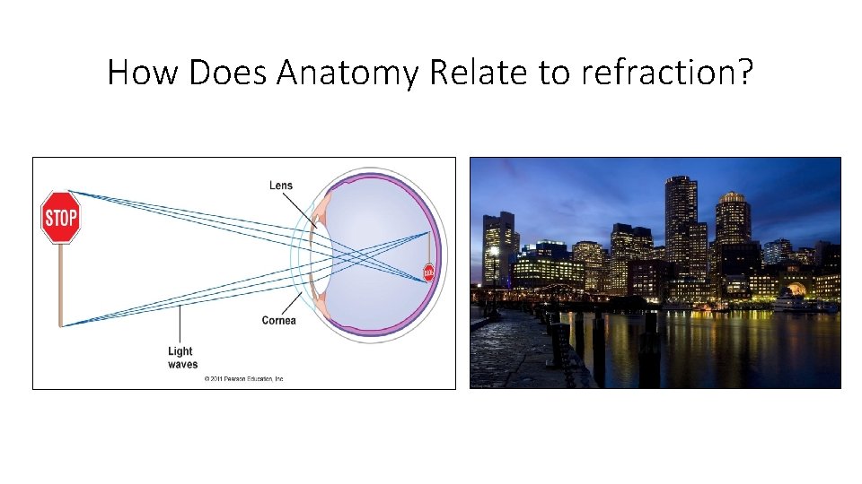 How Does Anatomy Relate to refraction? 