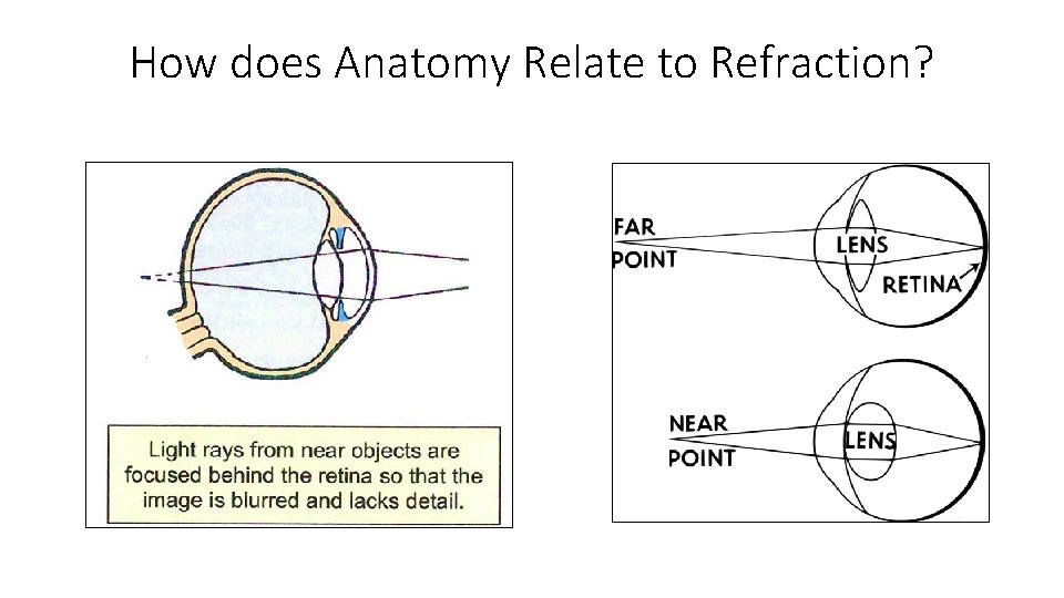 How does Anatomy Relate to Refraction? 