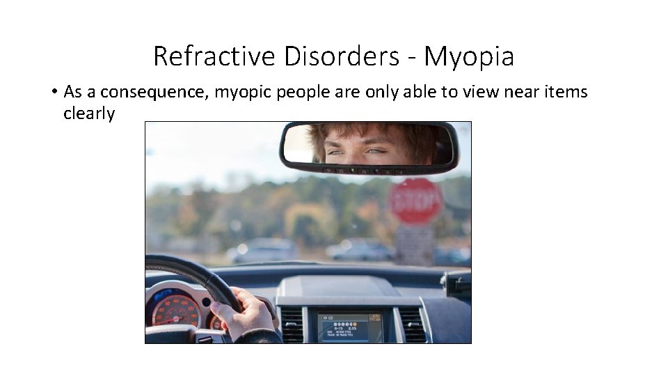 Refractive Disorders - Myopia • As a consequence, myopic people are only able to