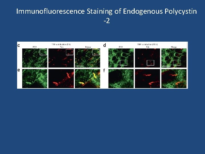 Immunofluorescence Staining of Endogenous Polycystin -2 