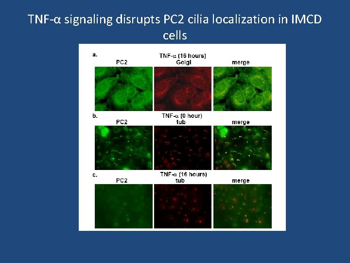 TNF-α signaling disrupts PC 2 cilia localization in IMCD cells 