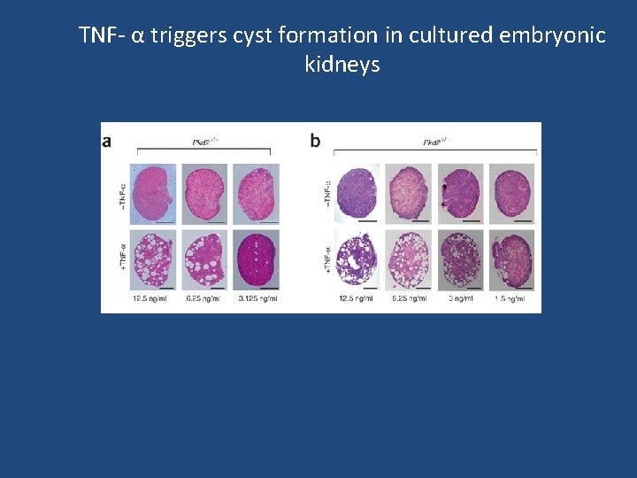 TNF- α triggers cyst formation in cultured embryonic kidneys 