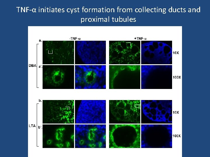 TNF-α initiates cyst formation from collecting ducts and proximal tubules 