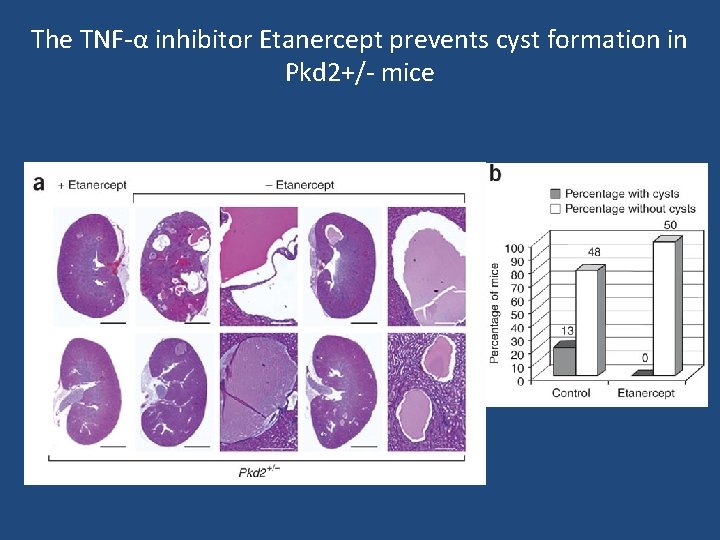 The TNF-α inhibitor Etanercept prevents cyst formation in Pkd 2+/- mice 