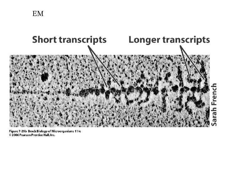 EM 