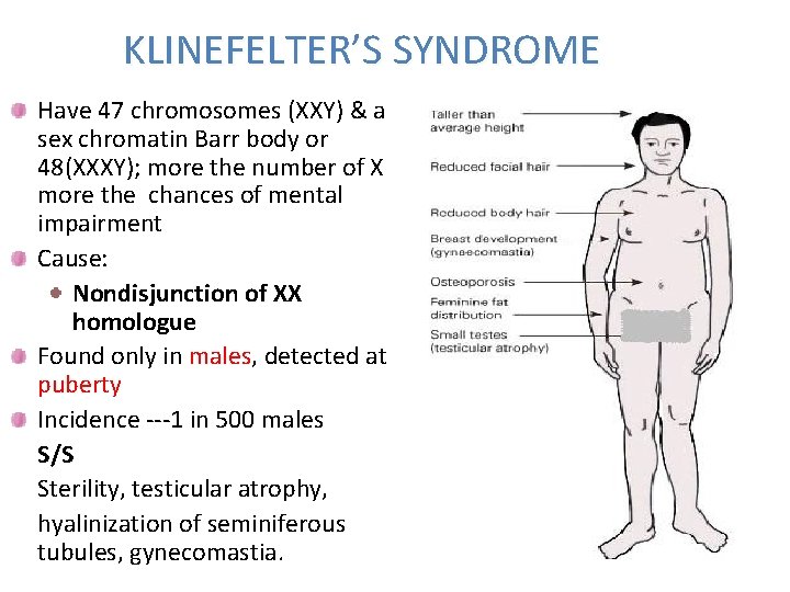 KLINEFELTER’S SYNDROME Have 47 chromosomes (XXY) & a sex chromatin Barr body or 48(XXXY);