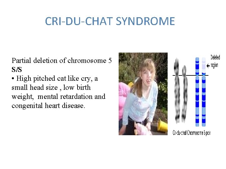 CRI-DU-CHAT SYNDROME Partial deletion of chromosome 5 S/S • High pitched cat like cry,