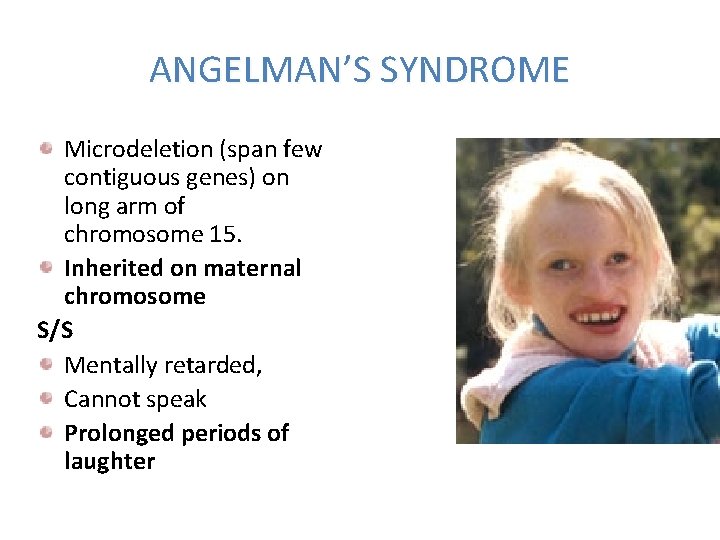 ANGELMAN’S SYNDROME Microdeletion (span few contiguous genes) on long arm of chromosome 15. Inherited