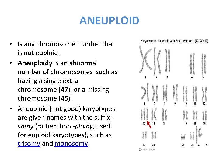 ANEUPLOID • Is any chromosome number that is not euploid. • Aneuploidy is an