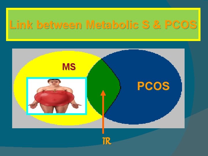 Link between Metabolic S & PCOS MS PCOS IR 