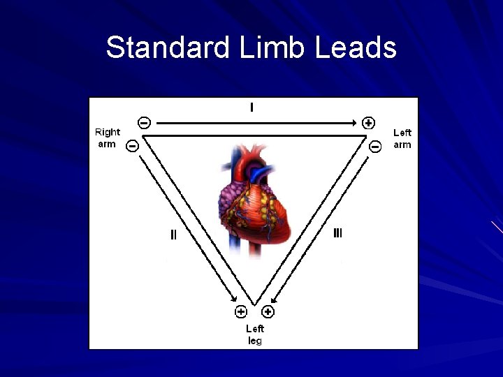 Standard Limb Leads 