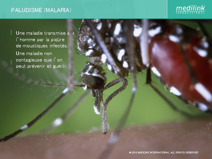 PALUDISME (MALARIA) | Une maladie transmise à l’homme par la piqûre de moustiques infectés.