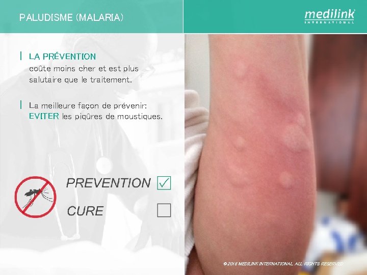 PALUDISME (MALARIA) | LA PRÉVENTION coûte moins cher et est plus salutaire que le