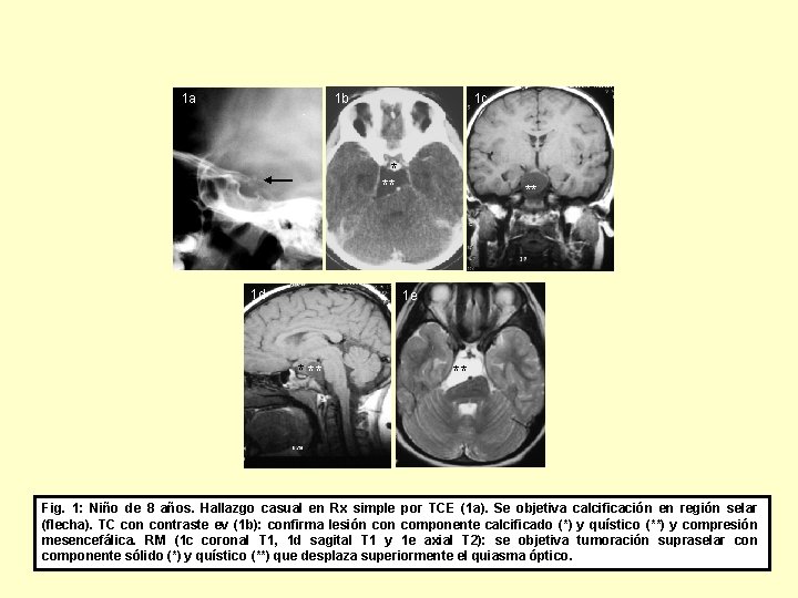 1 a 1 b 1 c * ** 1 d ** 1 e *