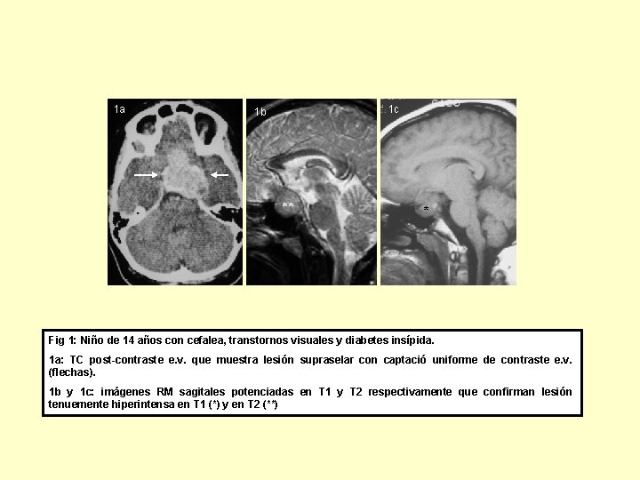 1 a 1 c 1 b ** * Fig 1: Niño de 14 años