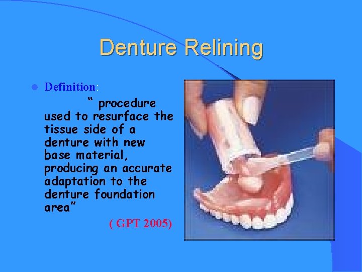 Denture Relining l Definition: “ procedure used to resurface the tissue side of a