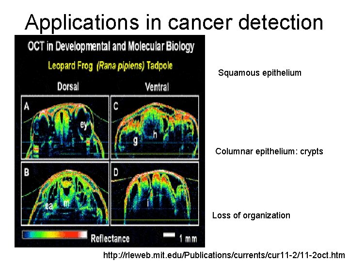 Applications in cancer detection Squamous epithelium Columnar epithelium: crypts Loss of organization http: //rleweb.