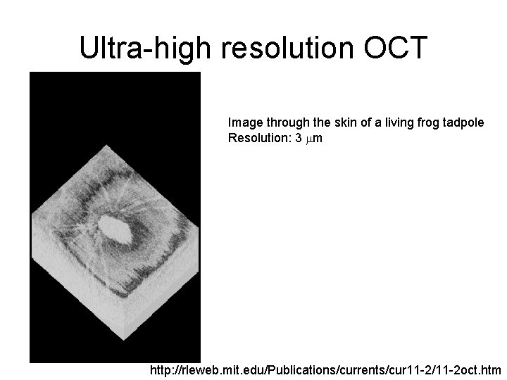Ultra-high resolution OCT Image through the skin of a living frog tadpole Resolution: 3