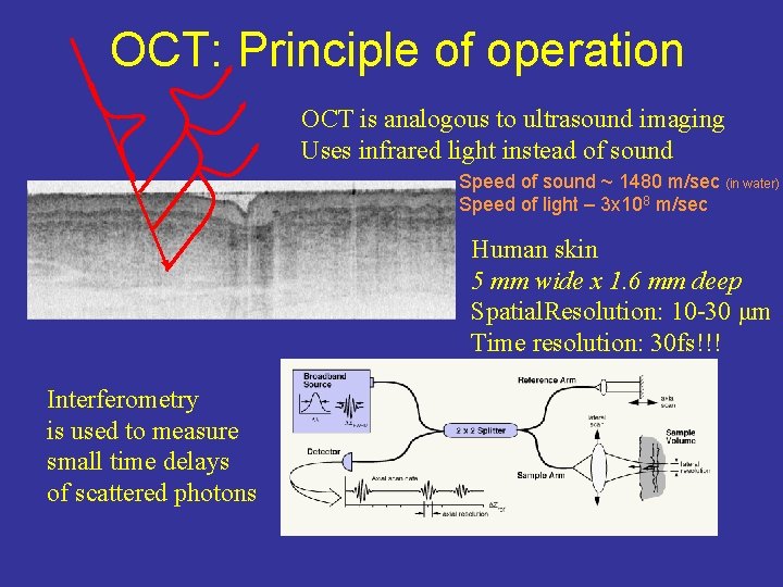 OCT: Principle of operation OCT is analogous to ultrasound imaging Uses infrared light instead