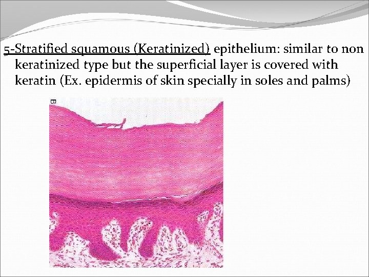 5 -Stratified squamous (Keratinized) epithelium: similar to non keratinized type but the superficial layer