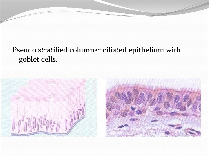 Pseudo stratified columnar ciliated epithelium with goblet cells. 