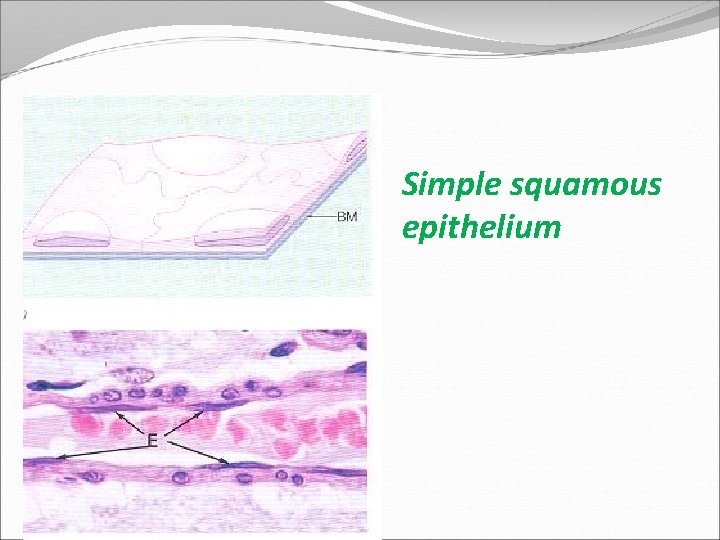 Simple squamous epithelium 