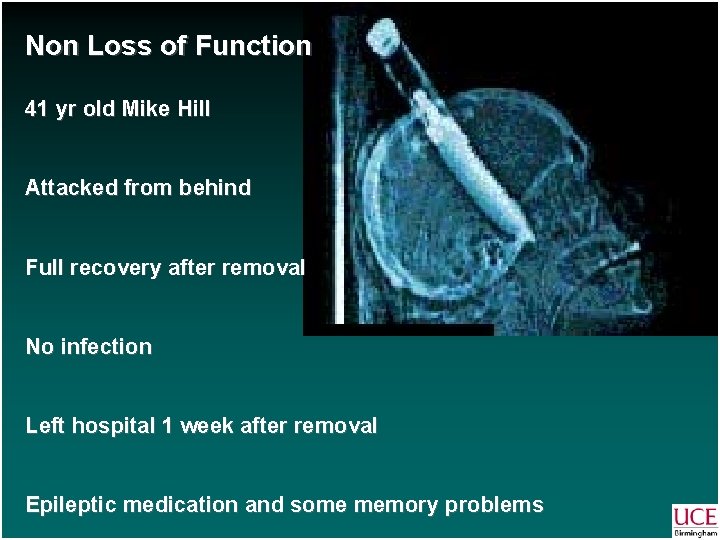 Non Loss of Function 41 yr old Mike Hill Attacked from behind Full recovery