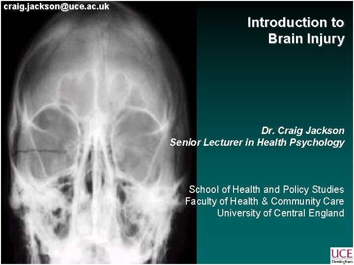 craig. jackson@uce. ac. uk Introduction to Brain Injury Dr. Craig Jackson Senior Lecturer in