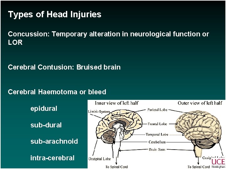 Types of Head Injuries Concussion: Temporary alteration in neurological function or LOR Cerebral Contusion: