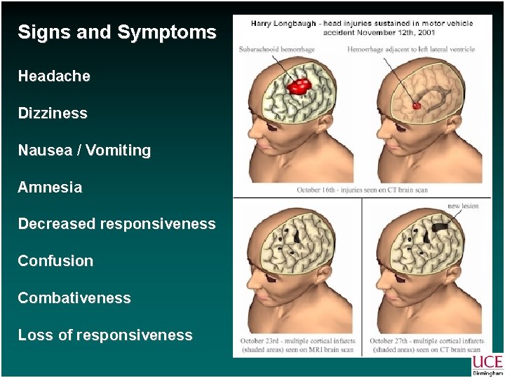 Signs and Symptoms Headache Dizziness Nausea / Vomiting Amnesia Decreased responsiveness Confusion Combativeness Loss