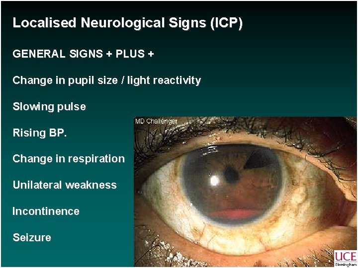 Localised Neurological Signs (ICP) GENERAL SIGNS + PLUS + Change in pupil size /