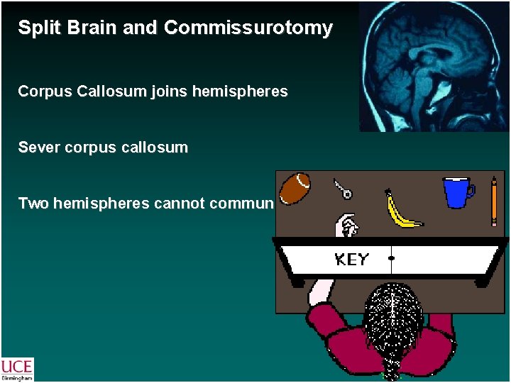 Split Brain and Commissurotomy Corpus Callosum joins hemispheres Sever corpus callosum Two hemispheres cannot