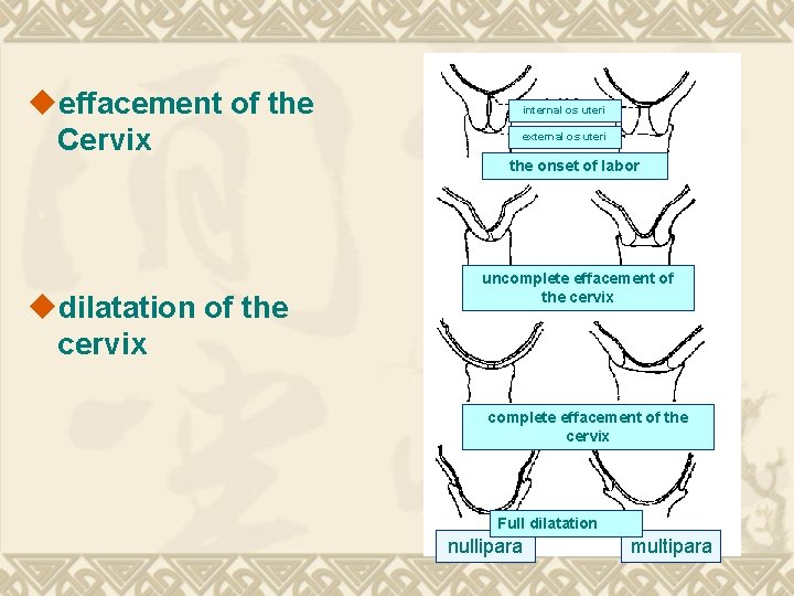 ueffacement of the Cervix internal os uteri external os uteri the onset of labor