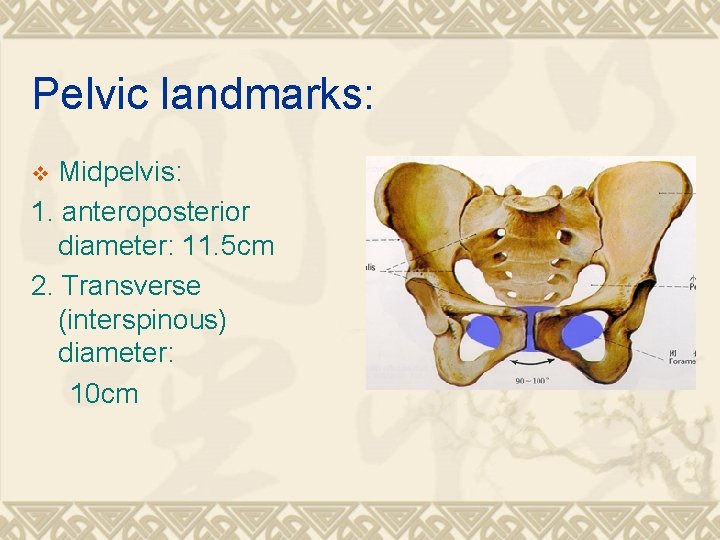 Pelvic landmarks: Midpelvis: 1. anteroposterior diameter: 11. 5 cm 2. Transverse (interspinous) diameter: 10