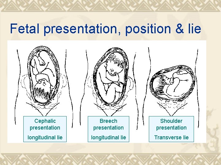Fetal presentation, position & lie Cephalic presentation Breech presentation Shoulder presentation longitudinal lie Transverse