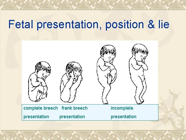 Fetal presentation, position & lie complete breech frank breech incomplete presentation 